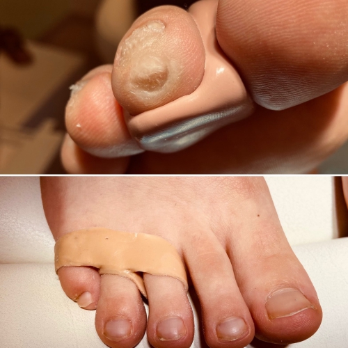 Orthoplastie